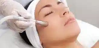 میکرودرم صورت رشت