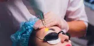 پاک کردن تاتو ابرو رشت